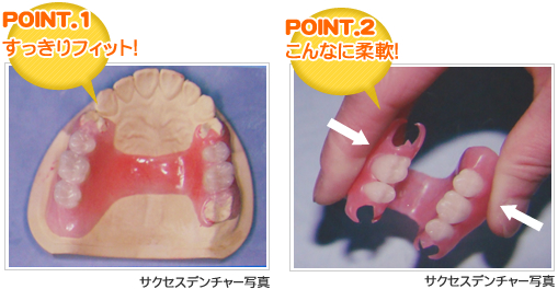 入れ歯の特徴