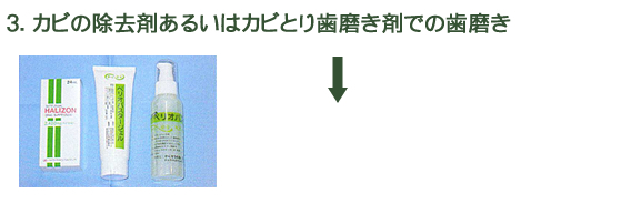 3.カビ除去剤あるいはカビとり歯磨き剤での歯磨き