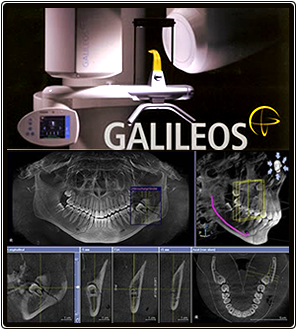 歯科用CT GALILEOS